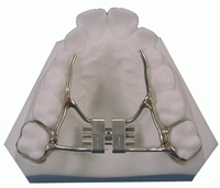Palatal Expander - Orthodontist in Glastonbury, CT
