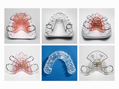 Glastonbury Orthodontics | Comprehensive Orthodontics, Orthodontic Appliances and Adult Orthodontics