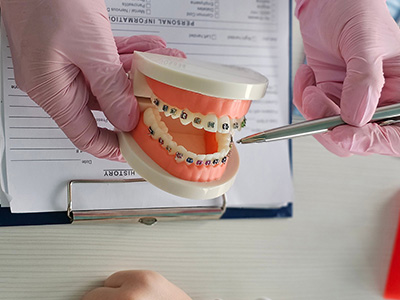 Glastonbury Orthodontics | Invisalign reg , Pediatric Orthodontics and Orthognathic Surgery