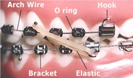 Glastonbury Orthodontics | Adult Orthodontics, Braces and Comprehensive Orthodontics