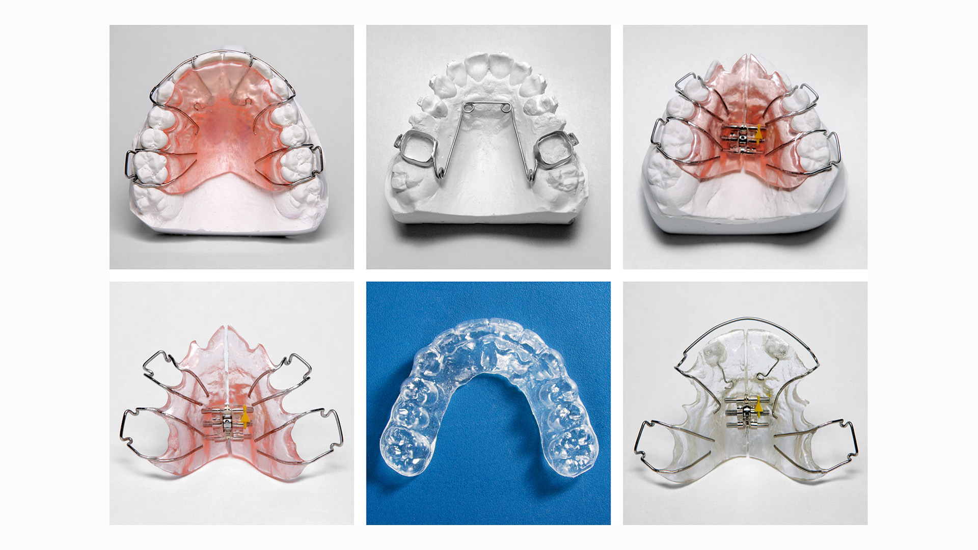 Glastonbury Orthodontics | Adult Orthodontics, Retainers and Comprehensive Orthodontics