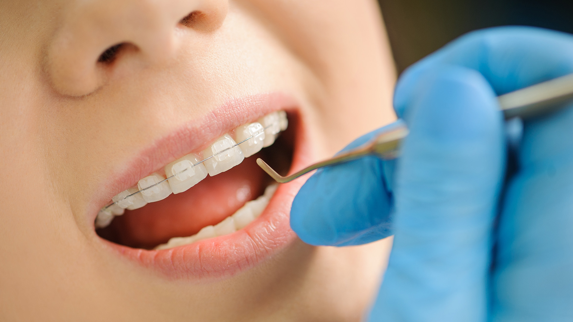Glastonbury Orthodontics | Orthognathic Surgery, Pediatric Orthodontics and Braces