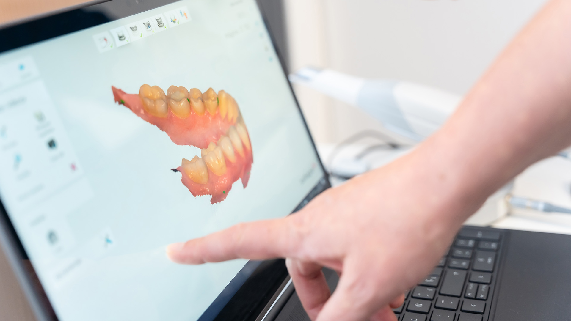 Glastonbury Orthodontics | Orthognathic Surgery, Retainers and Orthodontic Appliances