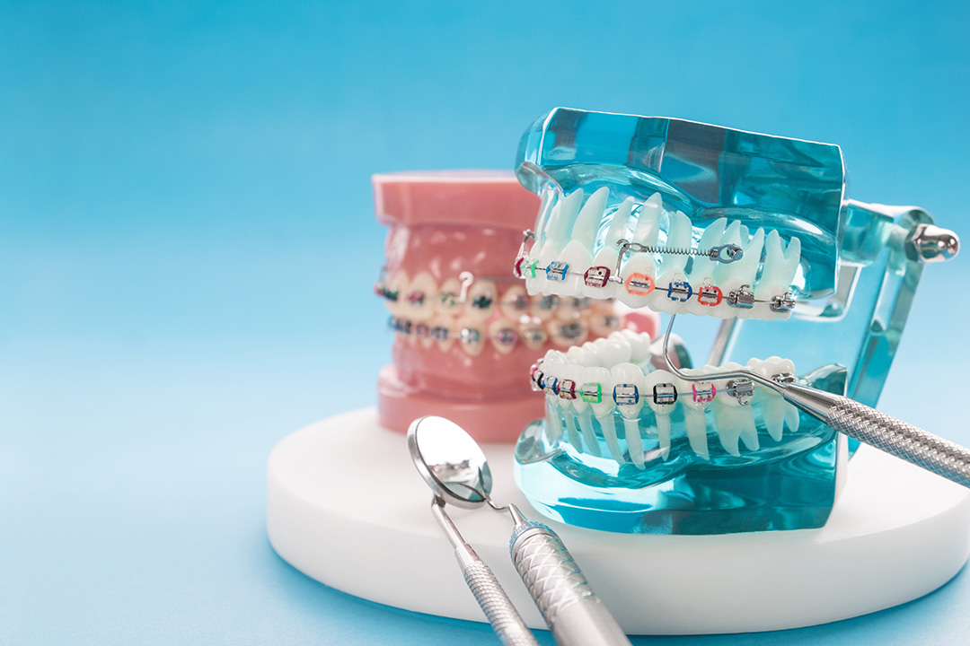 Glastonbury Orthodontics | Pediatric Orthodontics, Braces and Orthodontic Appliances
