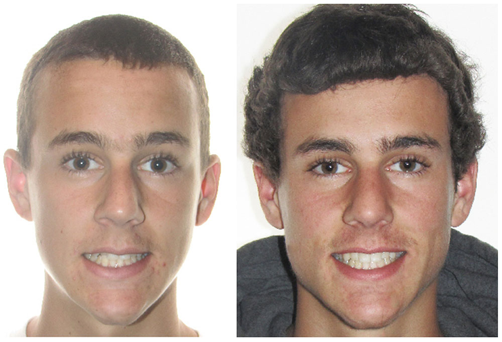 Glastonbury Orthodontics