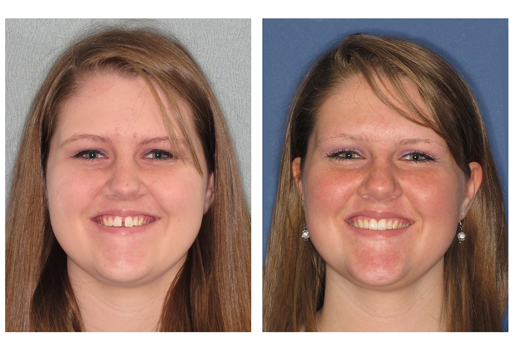 Glastonbury Orthodontics