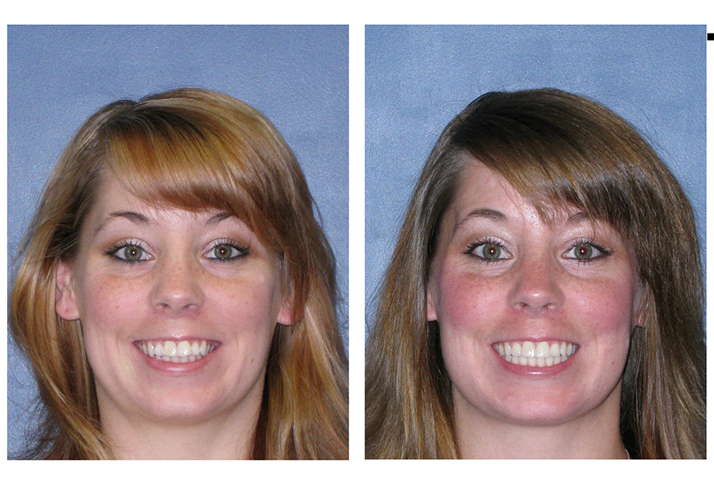 Glastonbury Orthodontics