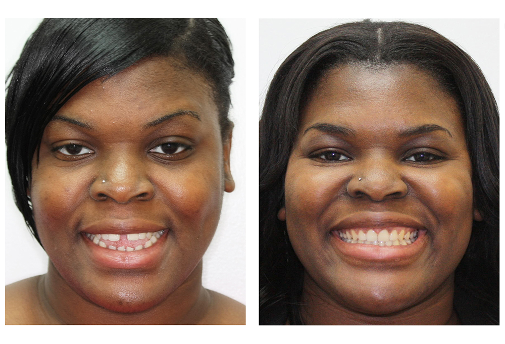 Glastonbury Orthodontics