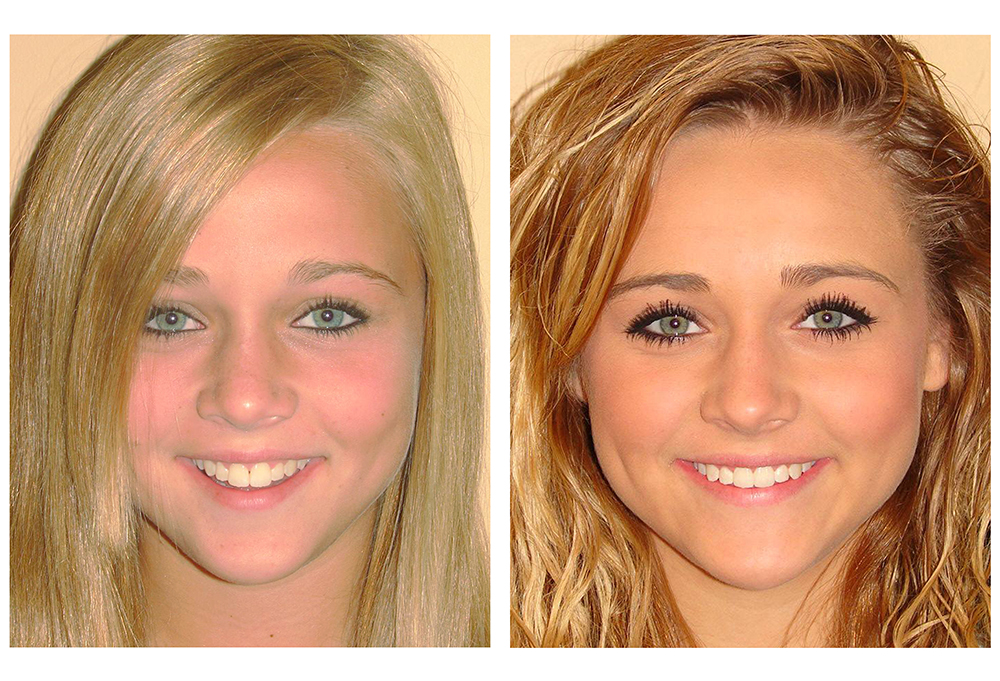 Glastonbury Orthodontics