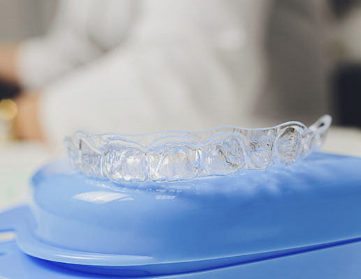 Glastonbury Orthodontics | Orthodontic Appliances, Early Treatment and Ceramic Braces