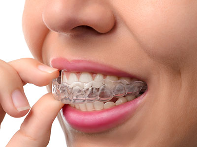 Glastonbury Orthodontics | Comprehensive Orthodontics, Orthognathic Surgery and Two Phase Orthodontic Treatment